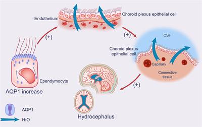 The pathogenesis of idiopathic normal pressure hydrocephalus based on the understanding of AQP1 and AQP4